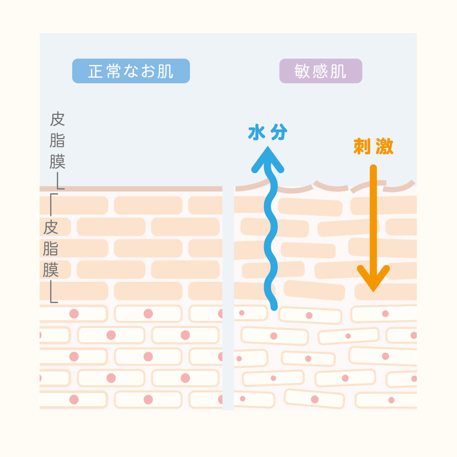 敏感肌 図解